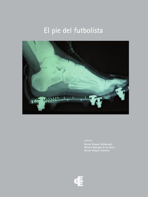 cover image of El pie del futbolista